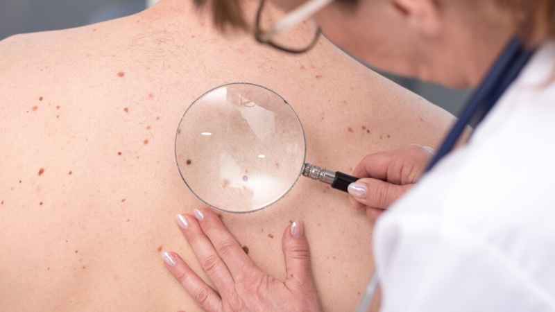 ESPECIALIDAD DE DERMATOLOGÍA EN TALAVERA EN HOSPITAL PARQUE MARAZUELA